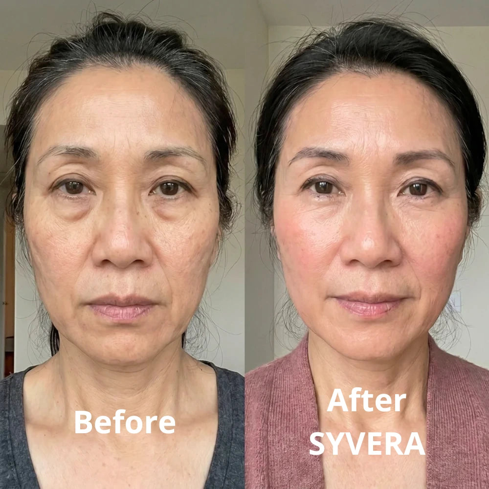 Diane transformation thumbnail