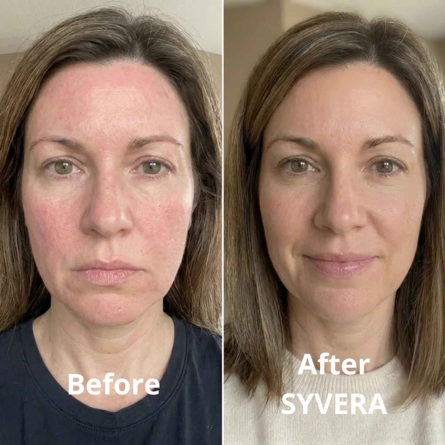 Linda transformation
