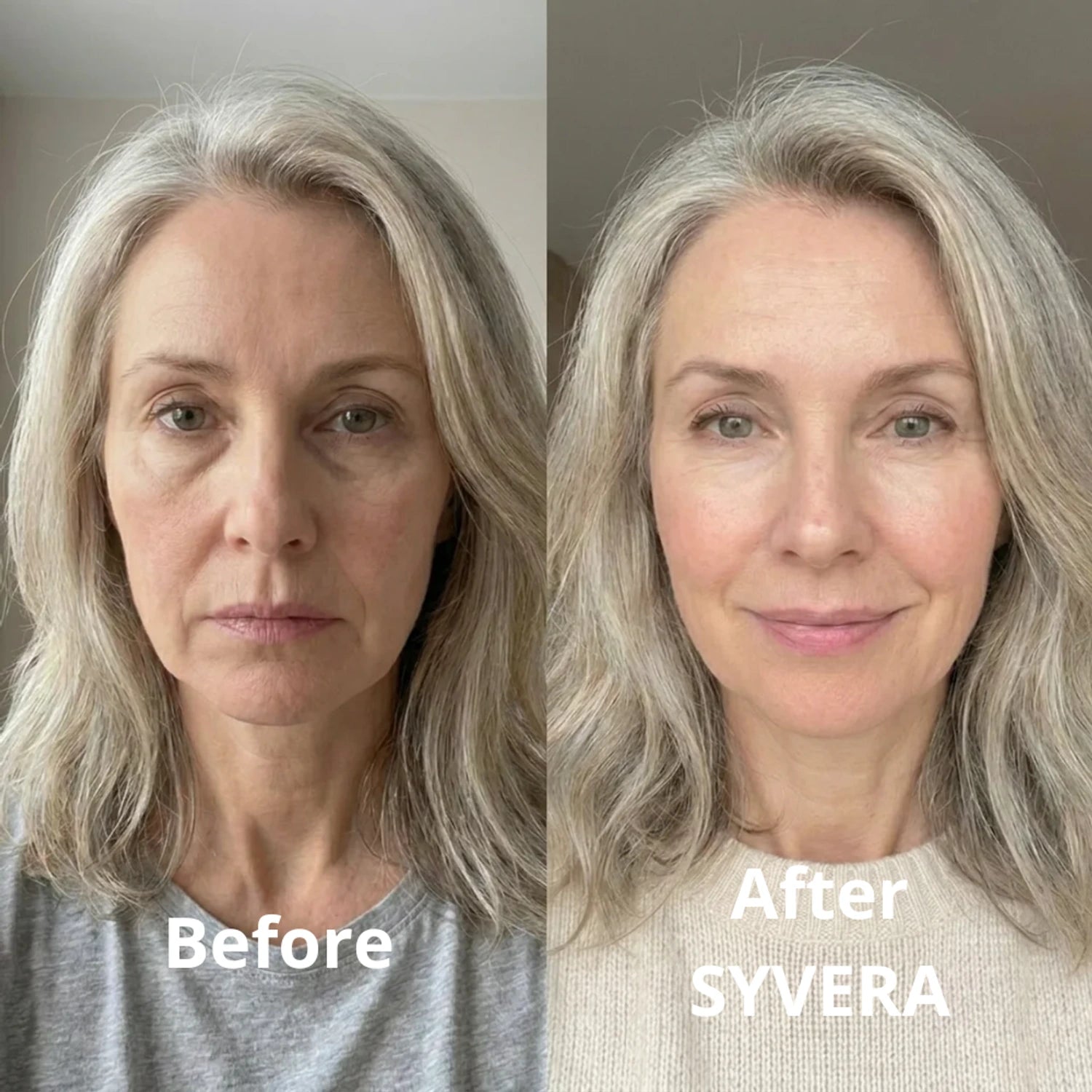 Sarah transformation