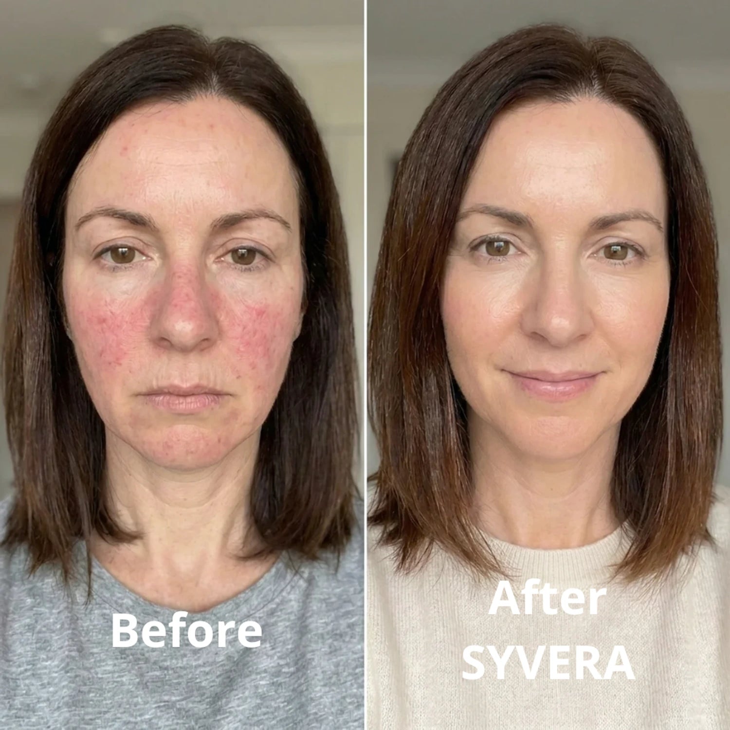 Jennifer T., 43 · Before / After SYVERA · Day 0 to Day 90 transformation
